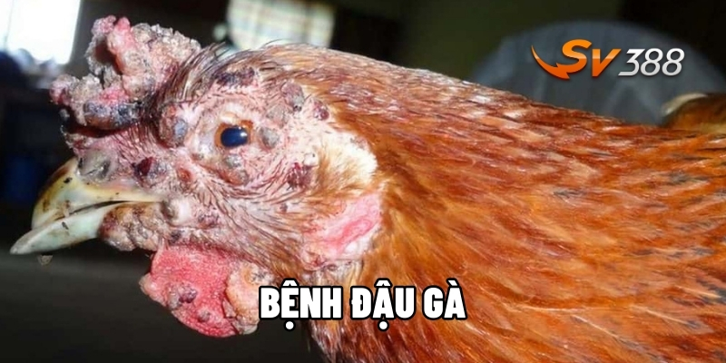 Bệnh đậu gà